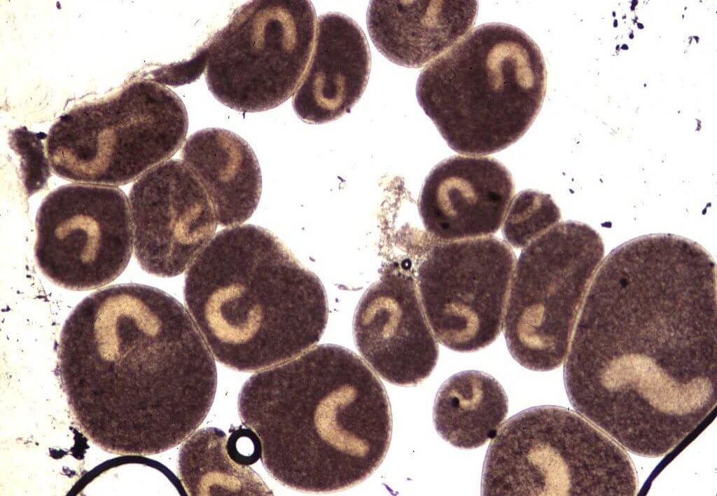 مشاهده میکروسکوپیک انگل ایک در قزل آلا توسط آزمایشگاه تخصصی آبزیان رویان پژوه کاوش پویا